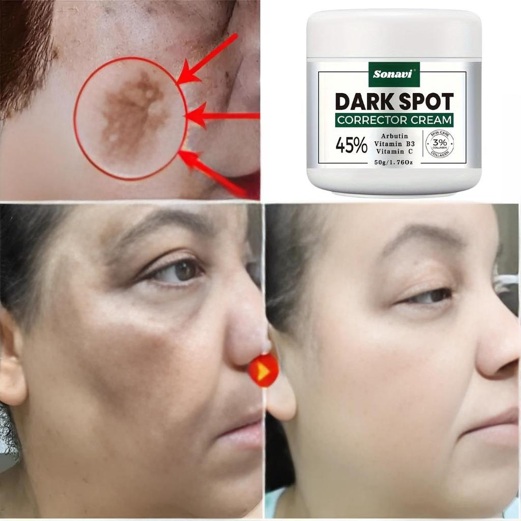 Krém na korekci tmavých skvrn, Rozjasnění pleti, Bělící krém, Rozjasnění pleti, Krém proti stárnutí pleti