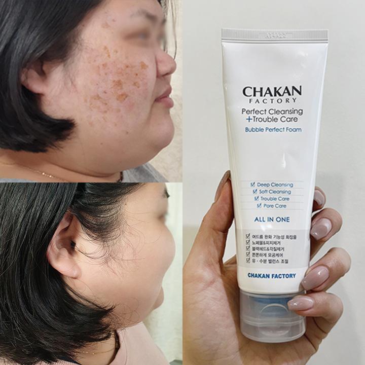 Tea Tree “Bubble Eraser” Spot & Pigmentation Foam