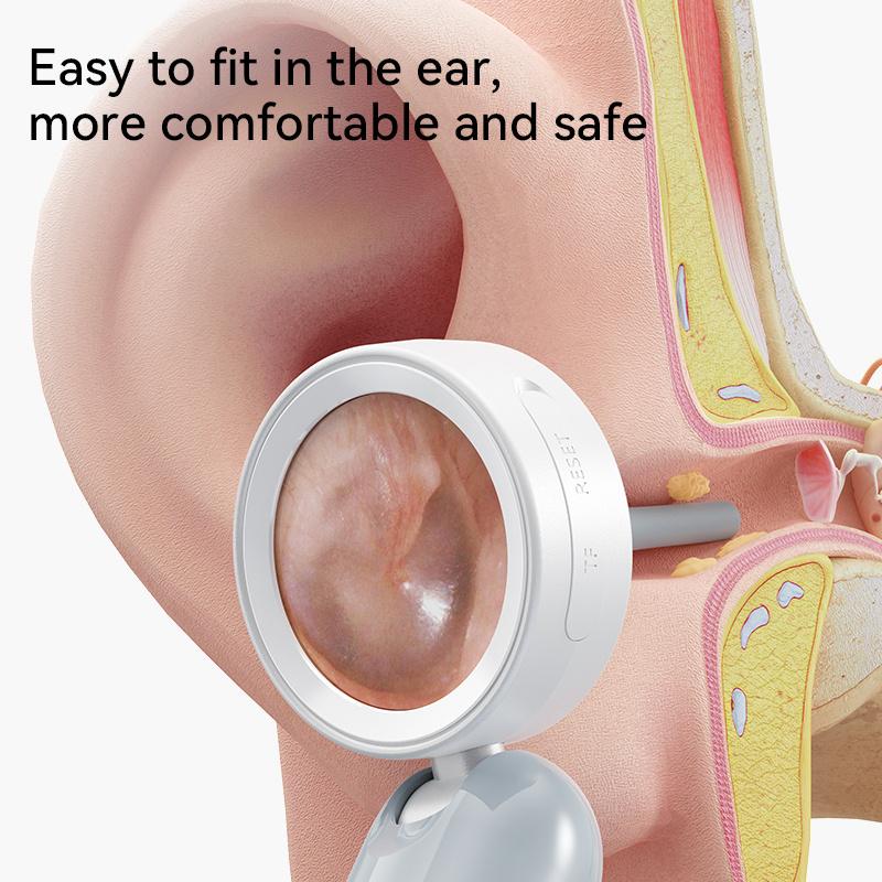 Inskam 4-in-1 Smart Ear & Nose Camera with Screen - HD 1080P, 90° Rotating Inspection Head, Includes Wax Removal Tool for Ears, Nose