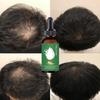 Natural Extract Baldness Repair Spray Hair Regrowth Lotion Haircare Hair Loss Oil