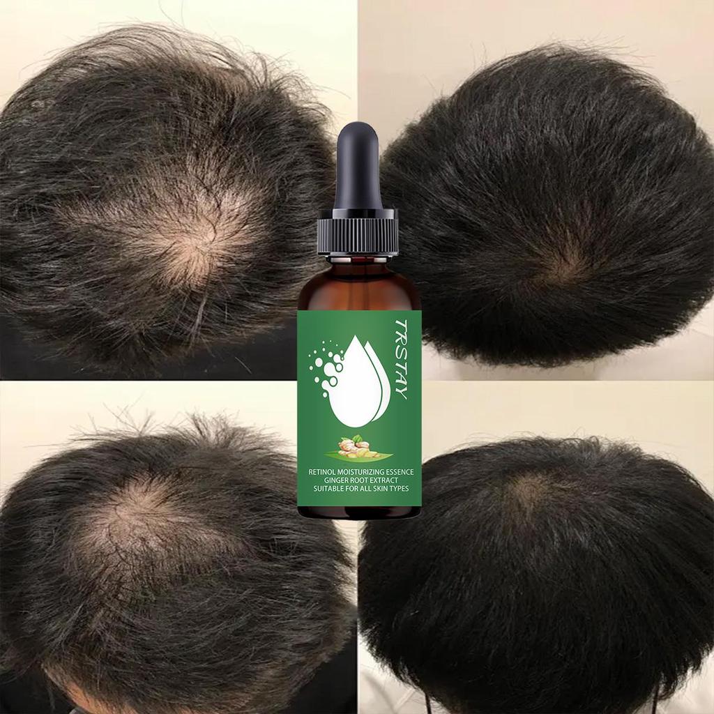 Natural Extract Baldness Repair Spray Hair Regrowth Lotion Haircare Hair Loss Oil