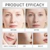 Firming Anti-aging Roller Microneedle Set Anti-aging And Wrinkle-Smoothing Facial Care Liquid Facial Micro-injection,15ML