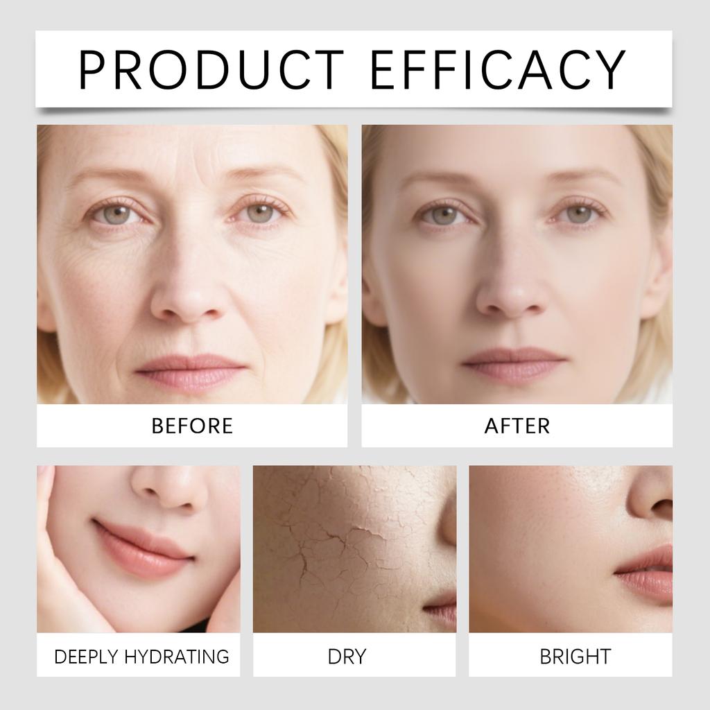 Firming Anti-aging Roller Microneedle Set Anti-aging And Wrinkle-Smoothing Facial Care Liquid Facial Micro-injection,15ML