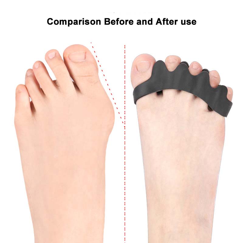 One Pair Toe Separator Silicone Separation Five Holes Separation Clip Foot Finger Guard Valgus Toe Overlapping Toe Separator