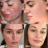medicube - Red Succinic Acid Serum
