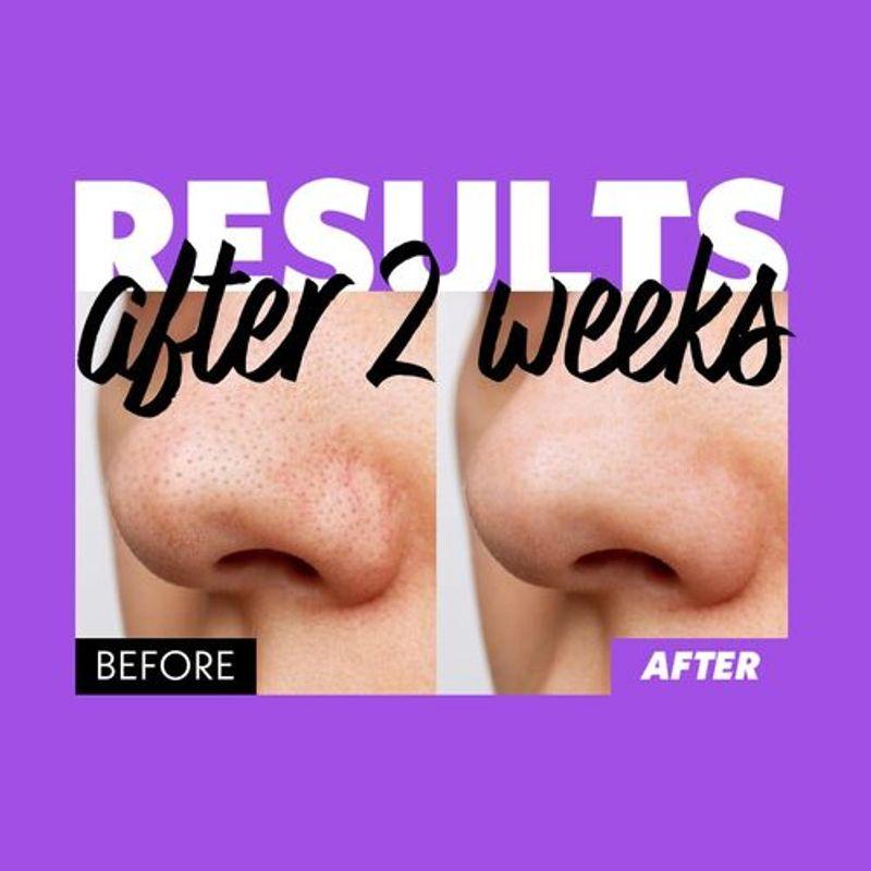 FATION Nosca9 Deep Pore Cleansing Foam 150ml