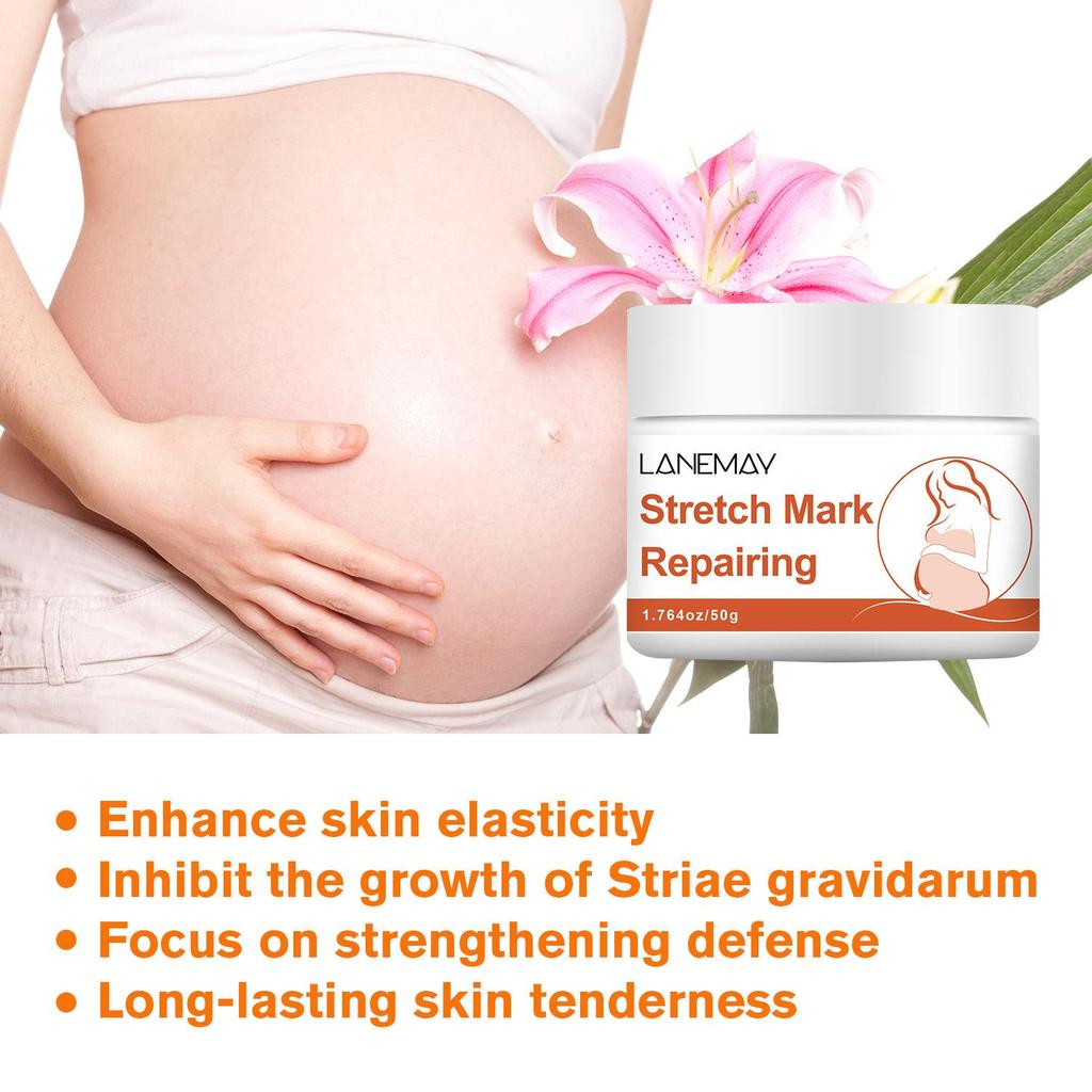 Stretch Mark Repairing-Long Lasting Skin Tenderness-Inhibit The Growth Of Striae Gravidarum-Safe To Use For Pregnant Women, 50g
