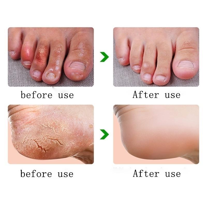 Rough Dry Cracked Hand Heel Skin Cream 
