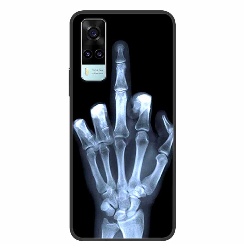 For Vivo Y53s 4G Case Animals Soft Silicone TPU Phone Back Cover Case for Vivo Y31 2021 Funda for Vivo Y53 s Y 31 Luxury Coque