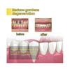Propolis Gum Care Gel, Propolis Oral Gum Repair Gel, Propolis Teeth Regrowth Dental Gel, Gum Instant Soothing Gel