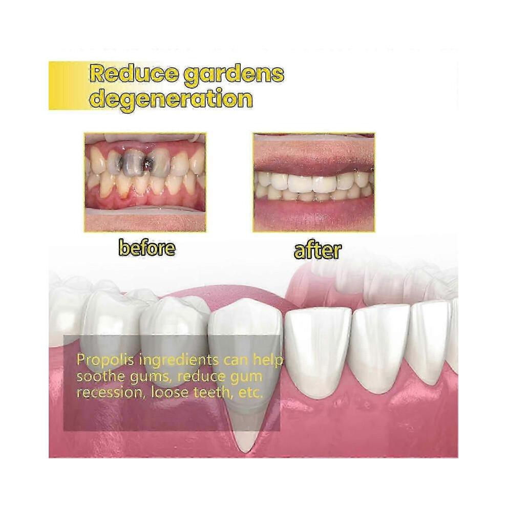 Propolis Gum Care Gel, Propolis Oral Gum Repair Gel, Propolis Teeth Regrowth Dental Gel, Gum Instant Soothing Gel