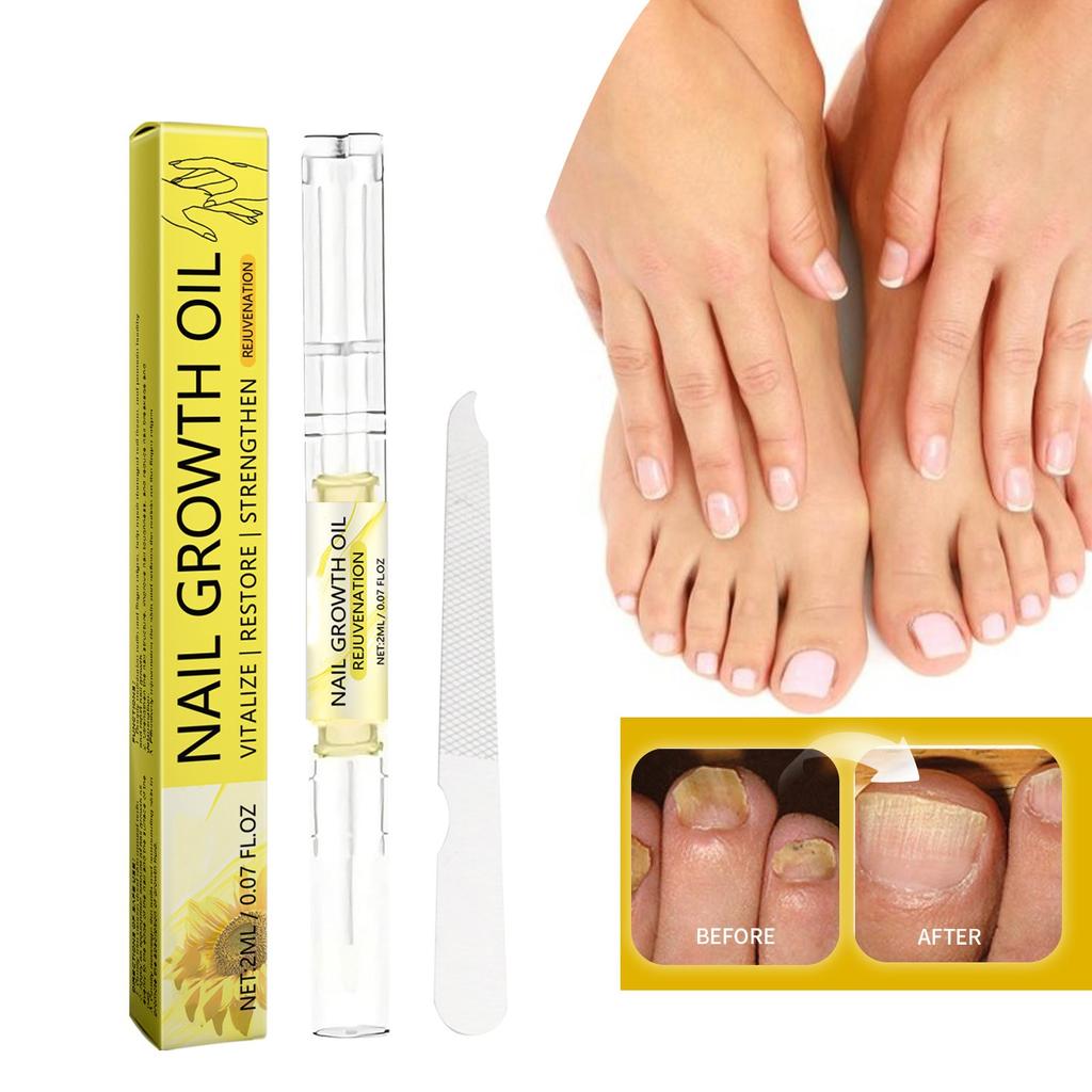 Nail Pen, Nail , Hand And Foot Nail Care, Nail Week Care, Gentle And Nourishing, Shiny Nail 2ml