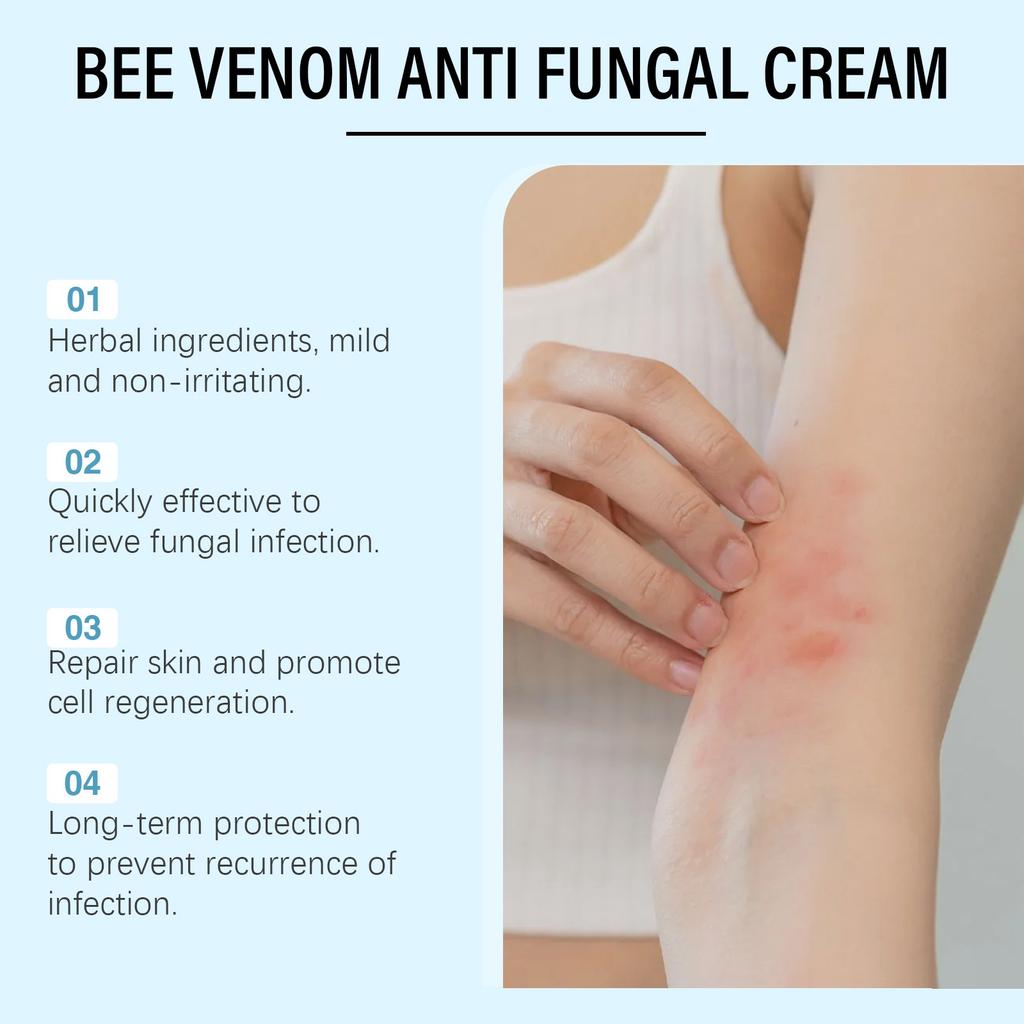 BeeAnti Fungal Cream,Fungus TreatmentCream, Itchy Skin Relief Cream,It Can Skin Ringworm Caused By Fungal .