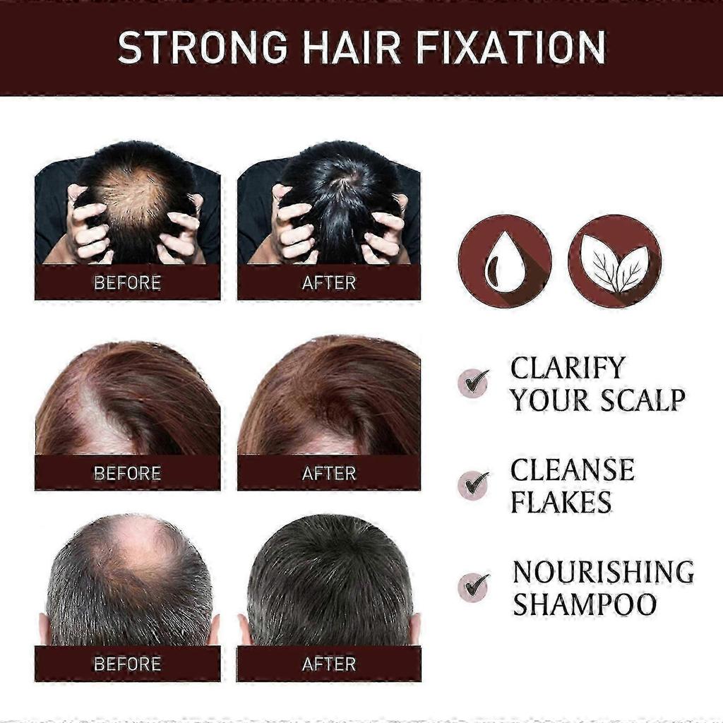 New model EELHOE rosemary hair oil, anti-hair loss, hair care, nourishing, thick and beautiful hair, scalp care oil
