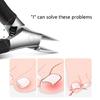 Ergonomic Toenail Clippers Ingrown Nails Dead Skin Remover Practical Thick Nails Cutter Suitable for Women and Men