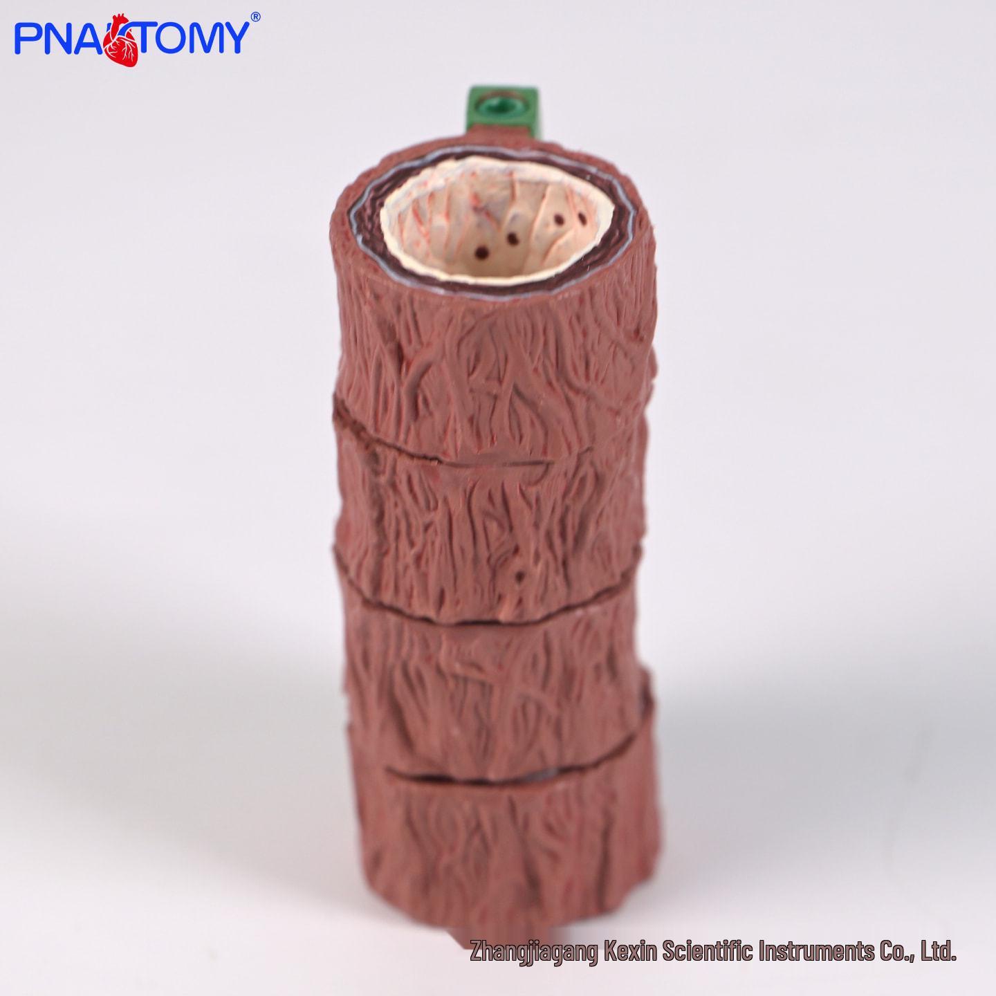 Four-Stage Human Artery Atherosclerosis Model Four-segment Vessel