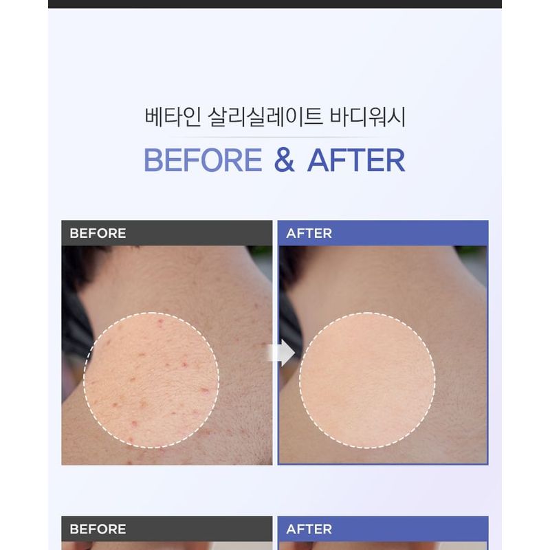 TOSOWOONG - Betaine Salicylate Body Wash