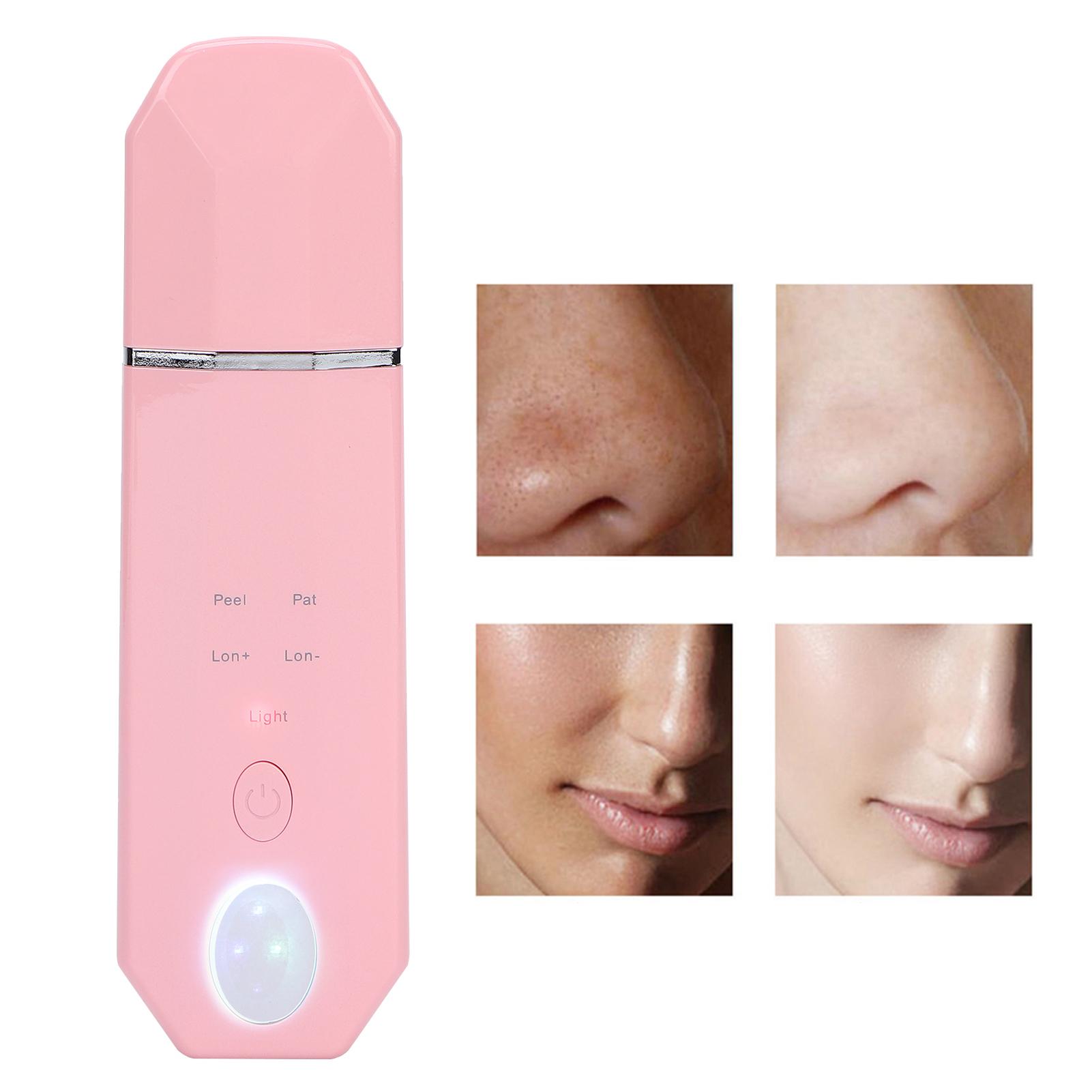 Facial Skin Exfoliator Electric Skin Scrubber Blackhead   Remover Pore Cleaner Machine