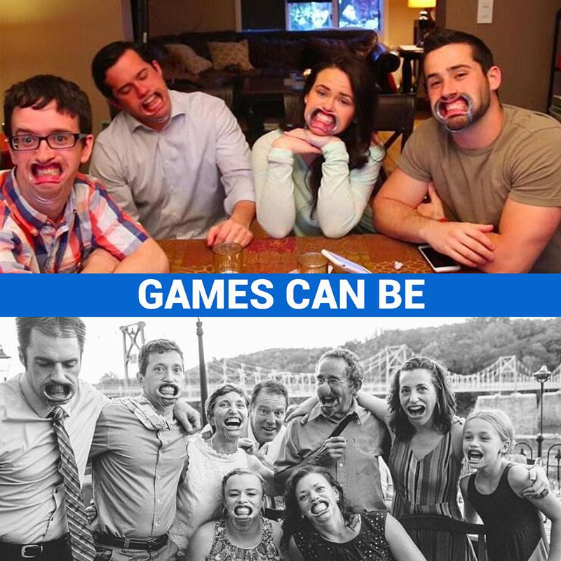 15 Pcs Dental Teeth Whitening Cheek Lip Retractor Mouth Opener C Shape 3 Sizes Mouth Expanders