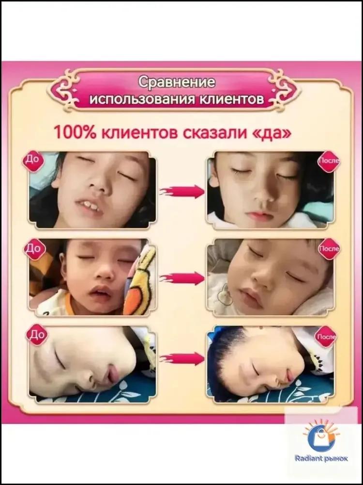 Patch of traditional Chinese medicine from hypertrophy adenoids Xiuyishu for correction of baby face, 1 box
