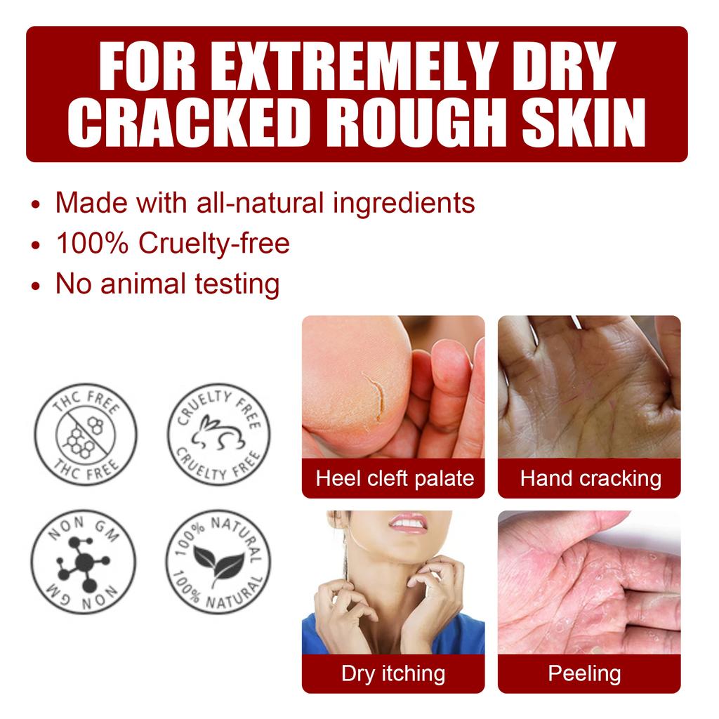 Jaysuing Fruit Acid Exfoliating Foot Mask Gently Exfoliates, Softens Calluses, Rejuvenates Skin, Moisturizes and Moisturizes Beautiful Feet