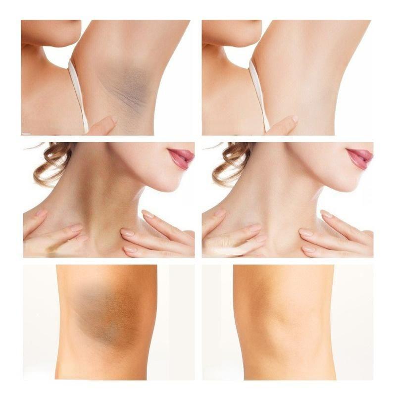 Underarm Whitening Cream Moisturizes the Skin, Refreshes and Smoothes the Body, Takes Care of the Neck, Back, Legs and Elbows, and Removes Color Spots
