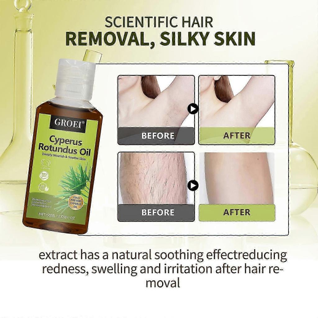 3x Cyperusöl Rotundus zur Haarentfernung - natürliches Cyperusöl, das das Wachstum von Körperhaaren reduziert, feuchtigkeitsspendend und beruhigend