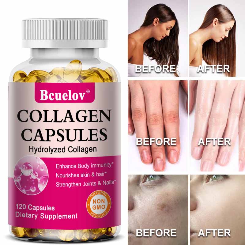 Bcuelov hydrolysierte Kollagenkapseln mit Vitamin C und Biotin pflegen Haut, Haare, Nägel und stärken das Immunsystem 120 Kapseln