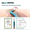Bebird 3 Ultra Smart Otoscope