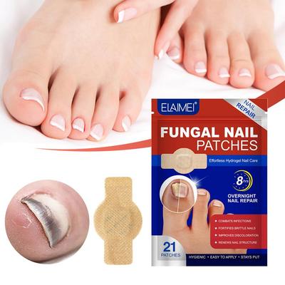 21Pcs Waterproof Foot Nail Repair Patch Grey Fungal Nail Thicken Soft Paronychia Ingrown Correction Sticke Fungal Nail Patches