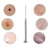 177---50/100pcs surgery sterile needle small mole removal pen needle mole freckles and other machine accessories