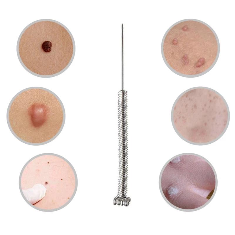 177---50/100pcs surgery sterile needle small mole removal pen needle mole freckles and other machine accessories