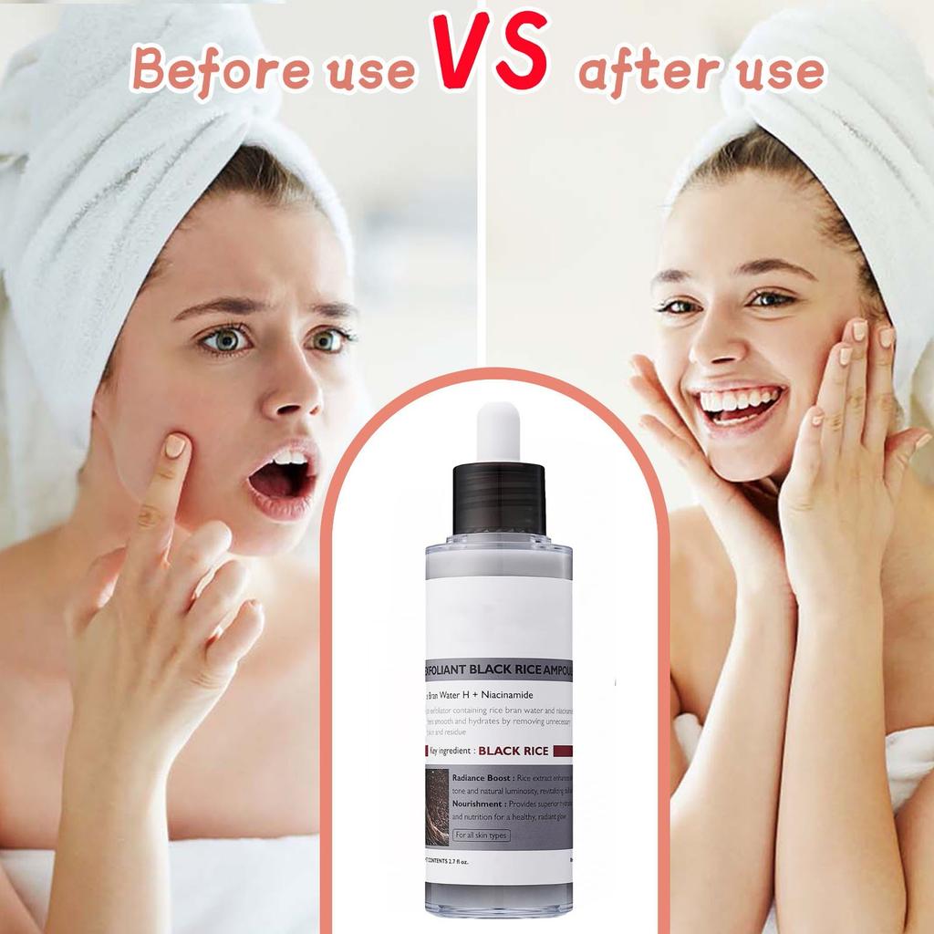 Black Rice Exfoliator Gentle Exfoliator For Face And Body To Remove Dead Skin Cells And Blackheads 80ml