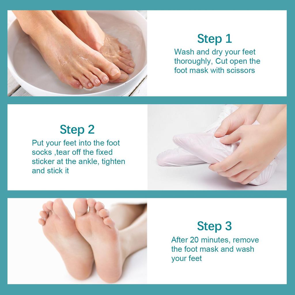 Coconut Oil Foot Masks-Intensive Moisturizing Treatment for Dry Cracked Feet, Soften Dry Skin & Improve Skin Texture,5 Pairs