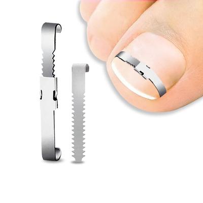 Ingrown Toenail Corrector Tools Pedicure Recover Embed Toe Nail Treatment Professional Ingrown Toenail Correction Foot Caretool
