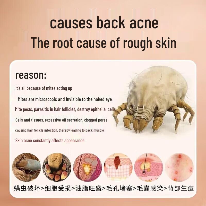 Shidanya Schwefel Peeling Schlamm Rubbel Duschgel