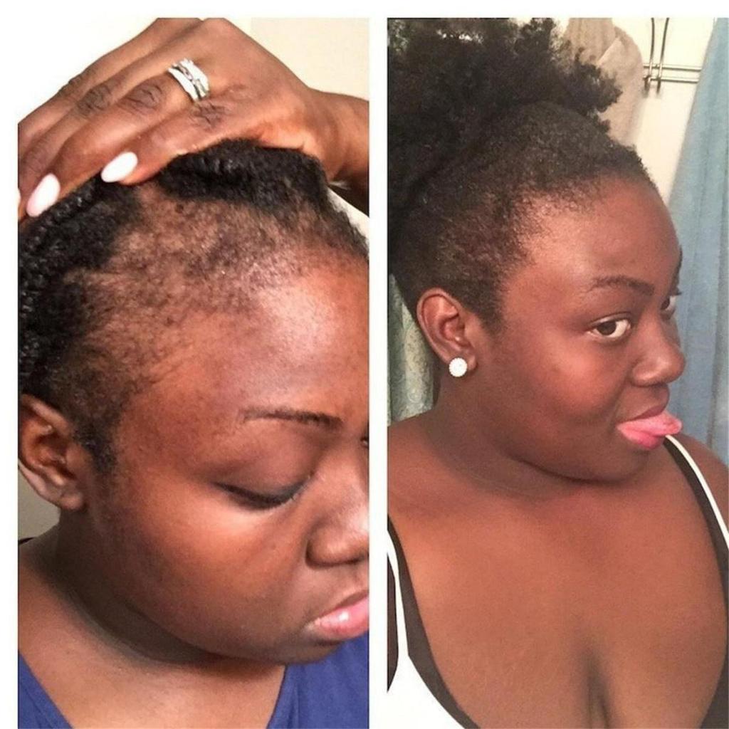 Huile de croissance capillaire entièrement naturelle pour rendre les cheveux plus épais et plus longs et stimuler la croissance des cheveux Produits capillaires Huile de croissance pour femmes noires