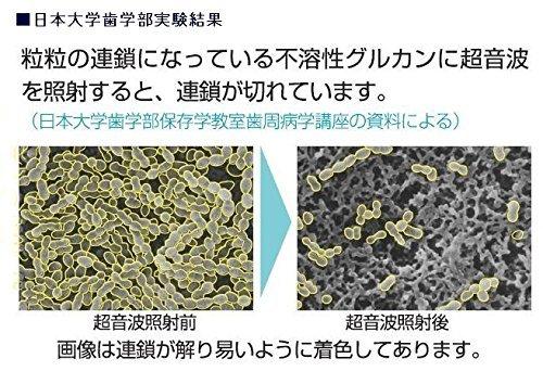 SmileX AU-300D Lavender 1.6MHz Ultrasonic Electric Toothbrush with 2 Replacement Toothbrush Packs