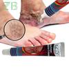 Anti-Inflammatory Oils Patches Effective Herbal Relief Spider Pain Relief Ointment Herb Plaster Beauty Body Care 30g