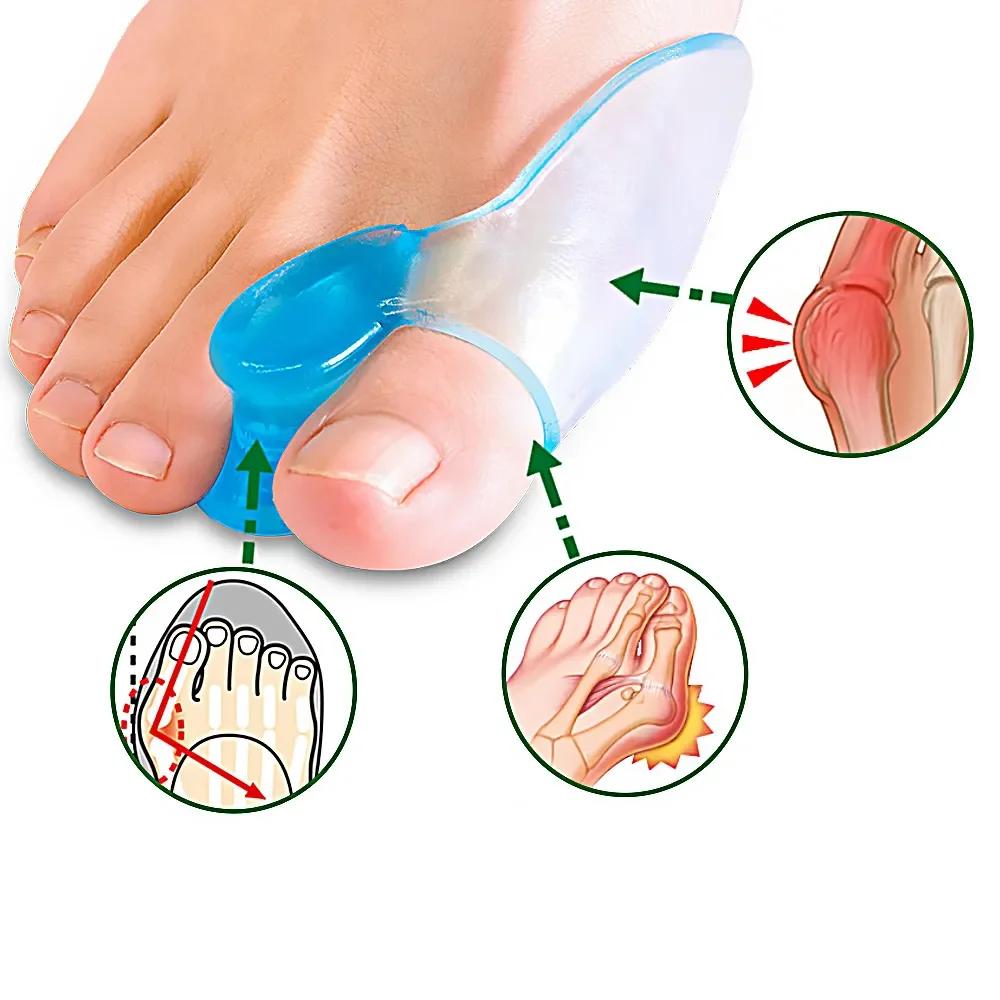 2pcs Bunion Valgus Corrector Use Male and Female Bigfoot Bones Day and Night to Separate Toe Sets Toe Dividers