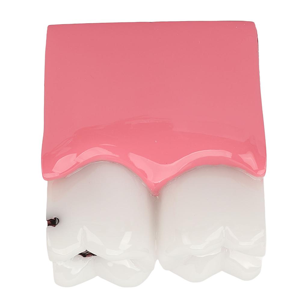 Dental Caries Model Tooth 6X Decay Demonstration Model for Teaching Study Laboratories