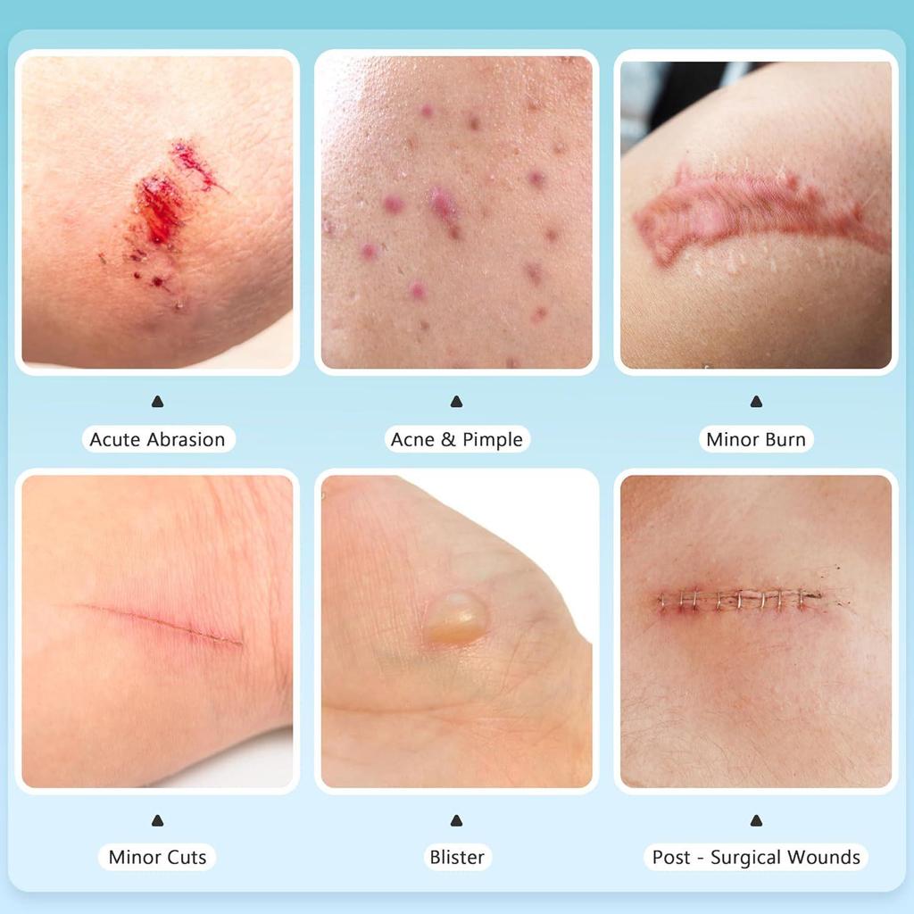 Waterproof Hydrocolloid Bandage Roll for DIY Wound Care