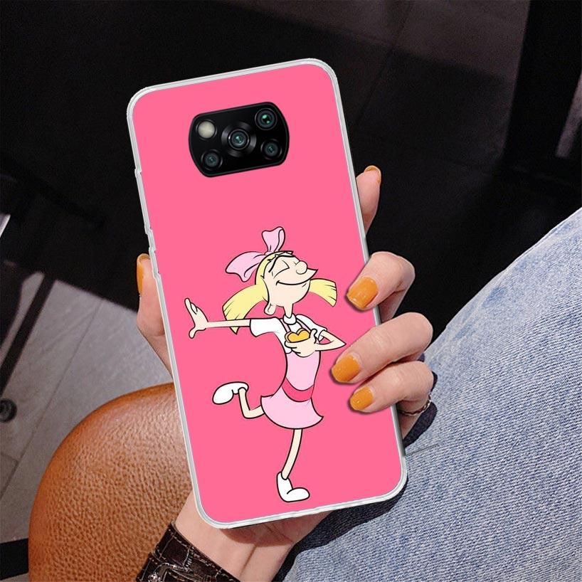 Cartoon Hey Arnold Fondos Phnoe Case for Xiaomi Poco X5 X6 X7 Pro X4 Gt F7 Ultra M8 M7 Redmi 15C 15 13C 13 12C 12 Unique Cover C