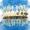 Dental Orthodontic Teeth Tooth Model 4 Kinds Brackets Ceramic and Metal Brackets for Patient Communication Dental Study Model