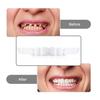 2 Pairs Comfort Upper and Lower Jaw Denture Denture Care Upper False Tooth Cover Snap Regain Confident Smile Perfect False Teeth