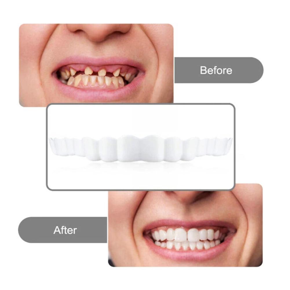 2 Pairs Comfort Upper and Lower Jaw Denture Denture Care Upper False Tooth Cover Snap Regain Confident Smile Perfect False Teeth