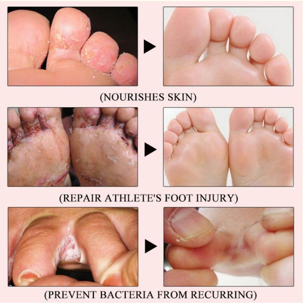 Cracked Repair Remove Callus Dead Skin Care Anti-dry Mask Exfoliating Socks Feet Care Foot Treatment