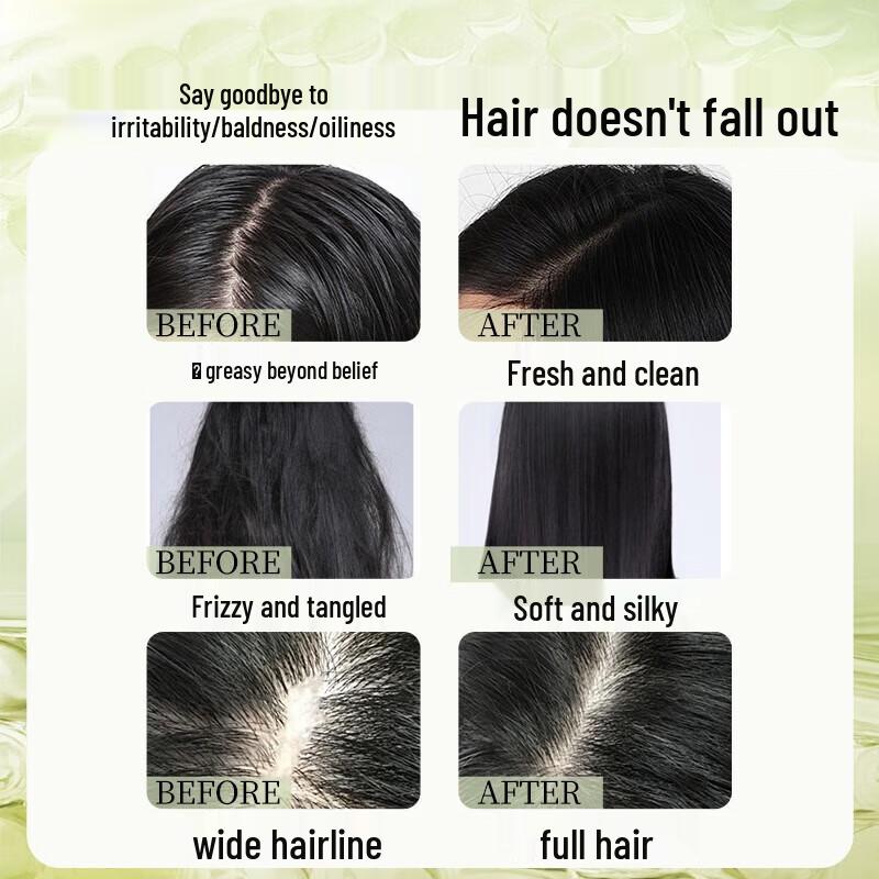 BaWang Anti-Hair Loss & Volumizing Scalp Care Shampoo