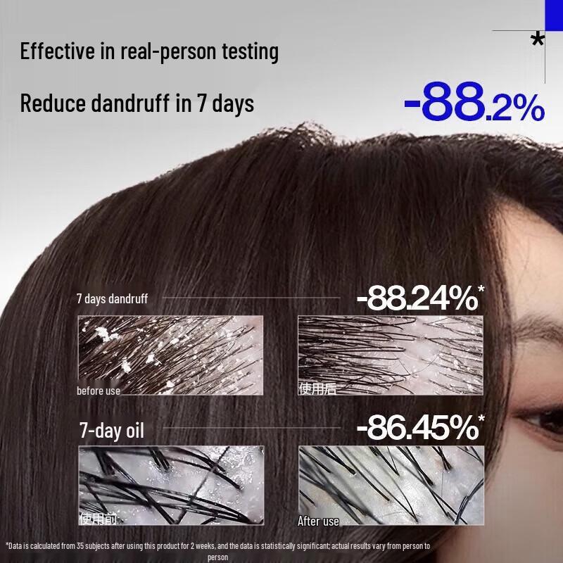 EHD Anti-Hair Loss and Anti-Dandruff Shampoo Set