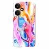 For Honor 400 5G (Global) Case Marble Pattern Printing Soft TPU Phone Cover